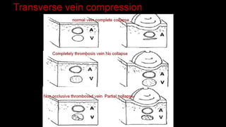 Duplex peripheral veins
