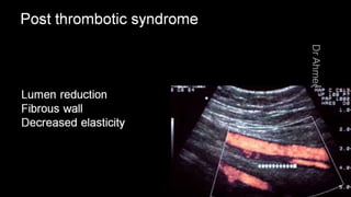 Duplex peripheral veins