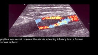 Duplex peripheral veins