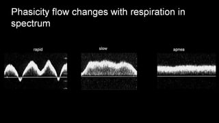 Duplex peripheral veins