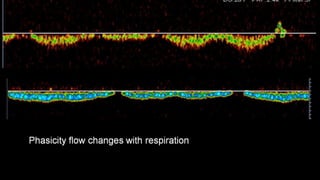 Duplex peripheral veins