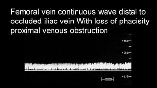 Duplex peripheral veins