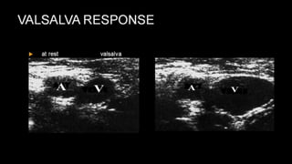 Duplex peripheral veins