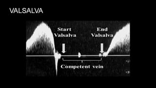Duplex peripheral veins