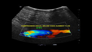 Duplex peripheral veins