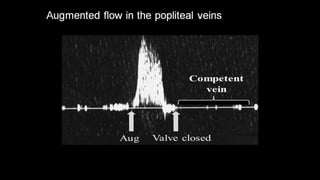 Duplex peripheral veins