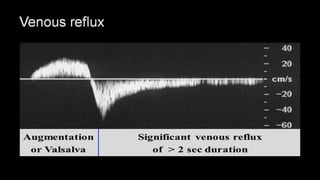 Duplex peripheral veins