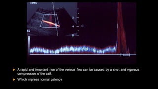 Duplex peripheral veins