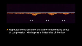 Duplex peripheral veins