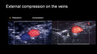 Duplex peripheral veins