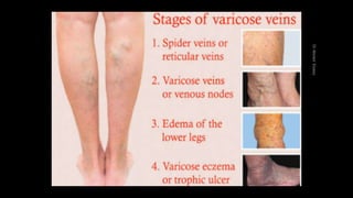 Duplex peripheral veins