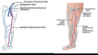 Duplex peripheral veins