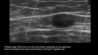 Duplex peripheral veins