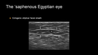 Duplex peripheral veins