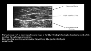 Duplex peripheral veins