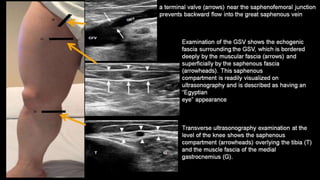 Duplex peripheral veins