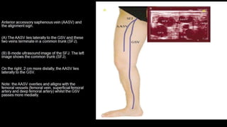 Duplex peripheral veins