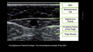 Duplex peripheral veins