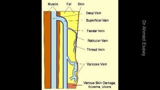 Duplex peripheral veins