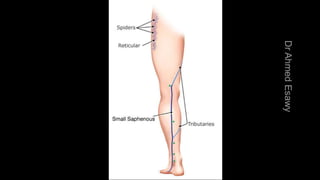 Duplex peripheral veins