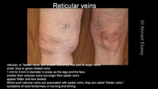 Duplex peripheral veins