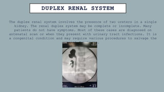 DUPLEX RENAL SYSTEM
The duplex renal system involves the presence of two ureters in a single
kidney. The renal duplex system may be complete or incomplete. Many
patients do not have symptoms. Most of these cases are diagnosed on
antenatal scan or when they present with urinary tract infections. It is
a congenital condition and may require various procedures to salvage the
renal functions.
 