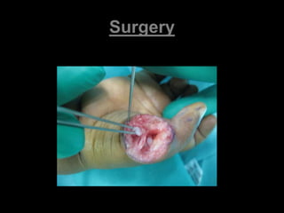 Surgery 
 