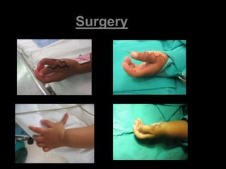 Surgery 
 