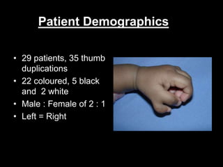 Patient Demographics 
• 29 patients, 35 thumb 
duplications 
• 22 coloured, 5 black 
and 2 white 
• Male : Female of 2 : 1 
• Left = Right 
 