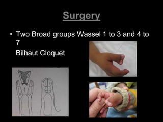 Surgery 
• Two Broad groups Wassel 1 to 3 and 4 to 
7 
Bilhaut Cloquet 
 
