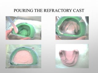 Duplication and wax up in rpd | PPT