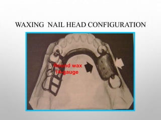Wax Pattern Rpd Duplication and wax up in rpd | PPT