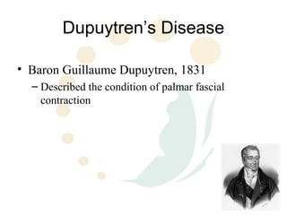 Dupuytren’s Disease

• Baron Guillaume Dupuytren, 1831
  – Described the condition of palmar fascial
    contraction
 
