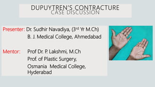 DUPUYTREN’S CONTRACTURE
CASE DISCUSSION
Presenter: Dr. Sudhir Navadiya, (3rd Yr M.Ch)
B. J. Medical College, Ahmedabad
Mentor: Prof Dr. P. Lakshmi, M.Ch
Prof. of Plastic Surgery,
Osmania Medical College,
Hyderabad
 