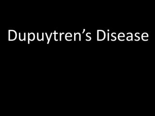 Dupuytren’s Disease
 