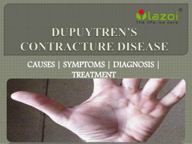 What is Dupuytren's contracture?