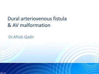 Dural arteriovenous fistula
& AV malformation
Dr.Aftab Qadir
 