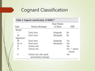 Cognard Classification Rupture Risk Sigmoid sinus Dural Arterio-Venous Fistula a Case Presentation .pptx