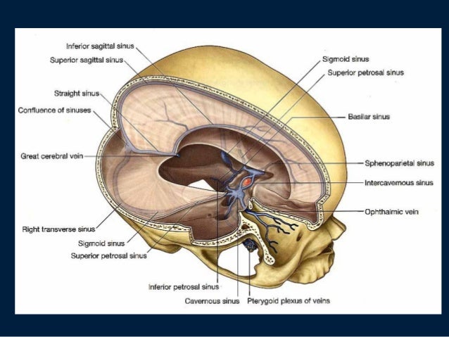 cavernous sinus thrombosis