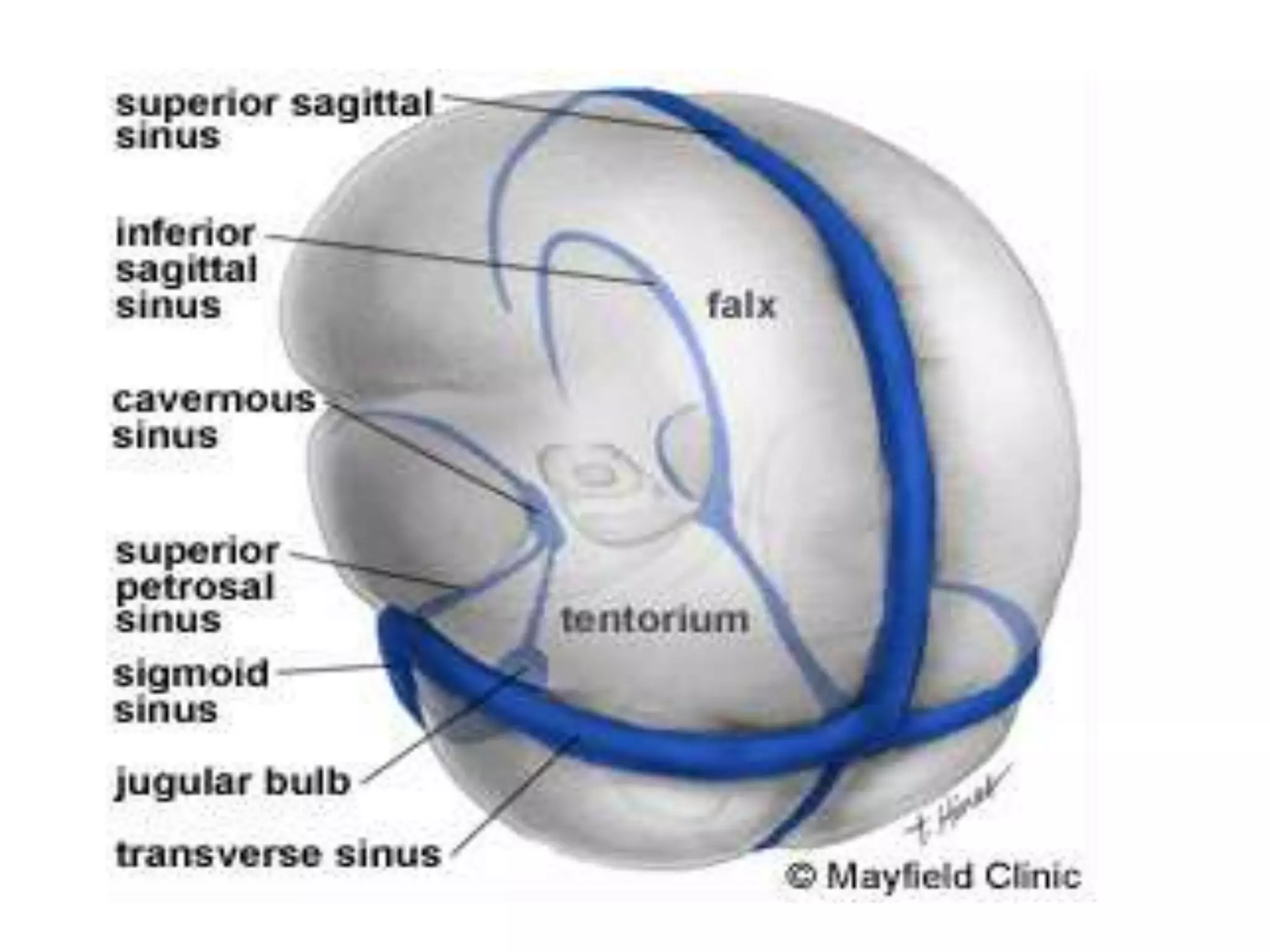 Dural venous sinuses, Ankur Saxena | PPT