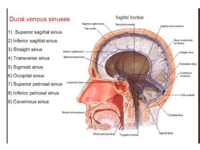 Dural Venous Sinuses