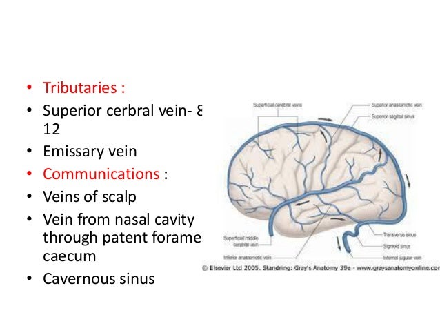 Dural Venous Sinuses