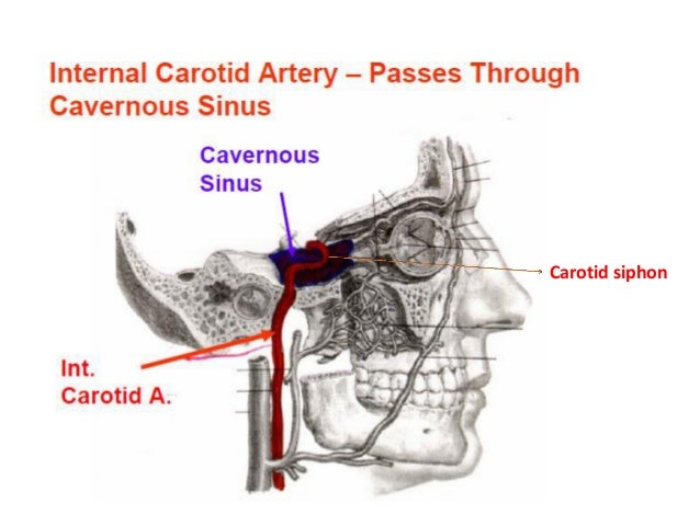 Dural Venous Sinuses Dural Venous Sinuses