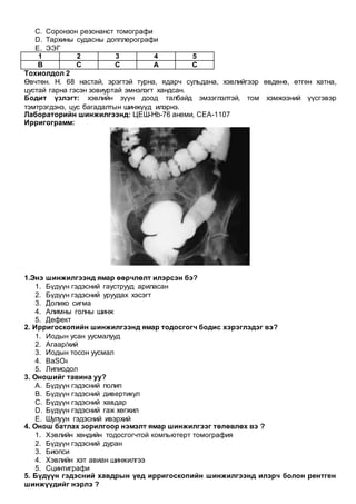 C. Соронзон резонанст томографи
D. Тархины судасны допплерографи
E. ЭЭГ
1 2 3 4 5
B C C A C
Тохиолдол 2
Өвчтөн. H. 68 настай, эрэгтэй турна, ядарч сульдана, хэвлийгээр өвдөнө, өтгөн хатна,
цустай гарна гэсэн зовиуртай эмнэлэгт хандсан.
Бодит үзлэгт: хэвлийн зүүн доод талбайд эмзэглэлтэй, том хэмжээний үүсгэвэр
тэмтрэгдэнэ, цус багадалтын шинжүүд илэрнэ.
Лабораторийн шинжилгээнд: ЦЕШ-Hb-76 анеми, CEA-1107
Ирригограмм:
1.Энэ шинжилгээнд ямар өөрчлөлт илэрсэн бэ?
1. Бүдүүн гэдэсний гауструуд ариласан
2. Бүдүүн гэдэсний уруудах хэсэгт
3. Долихо сигма
4. Алимны голны шинж
5. Дефект
2. Ирригоскопийн шинжилгээнд ямар тодосгогч бодис хэрэглэдэг вэ?
1. Иодын усан уусмалууд
2. Агаар/хий
3. Иодын тосон уусмал
4. BaSO4
5. Липиодол
3. Оношийг тавина уу?
A. Бүдүүн гэдэсний полип
B. Бүдүүн гэдэсний дивертикул
C. Бүдүүн гэдэсний хавдар
D. Бүдүүн гэдэсний гаж хөгжил
E. Шулуун гэдэсний ивэрхий
4. Онош батлах зорилгоор нэмэлт ямар шинжилгээг төлөвлөх вэ ?
1. Хэвлийн хөндийн тодосгогчтой компьютерт томография
2. Бүдүүн гэдэсний дуран
3. Биопси
4. Хэвлийн хэт авиан шинжилгээ
5. Сцинтиграфи
5. Бүдүүн гэдэсний хавдрын үед ирригоскопийн шинжилгээнд илэрч болон рентген
шинжүүдийг нэрлэ ?
 