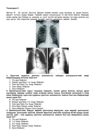 Тохиолдол 5
Өвчтөн Я . 55 настай. Эрэгтэй. Дөрвөн жилийн өмнөөс цээж орчмоор нь өвдөх болсон.
Даралт тогтмол өндөр байдаг. Чихрийн шижин оношлогдоод 10 жил болж байгаа. Өнөөдөр
өглөө ажилд явж байхад нь цээжээр нь гэнэт хүчтэй хатгуулан өвдсөн тул шууд эмнэлэг рүү
хүрч ирсэн. Эмч яаралтай цээжний хөндийн рентген шинжилгээ хийхийг зөвлөв.
1. Зүрх-том судасны рентген шинжилгээг хийхдээ шинжлүүлэгчийг ямар
байрлалуудад зогсоож хийх вэ?
1. Эгц урд байрлал
2. Баруун урд буюу 1-р ташуу байрлал
3. Зүүн урд буюу 2-р ташуу байрлал
4. Зүүн хажуу байрлал
5. Арын байрлал
2. Шинжлүүлэгчийн гарыг ташаанд тавиулж, тохойг урагш болгон, өвчүүг дунд
шугаманд, өөрөөр хэлбэл хоёр эгэмний өвчүү талын төгсгөлийг өвчүүний 2 талд
ижил байрлуулж зүрх-том судасны рентген шинжилгээг хийсэн бол аль байрлалаар
авсан зураг бэ?
A. Эгц урд байрлал
B. Баруун урд буюу 1-р ташуу байрлал
C. Зүүн урд буюу 2-р ташуу байрлал
D. Зүүн буюу баруун хажуу байрлал
E. Арын байрлал Иодын тосон уусмал
3. Шинжлүүлэгчийн баруун мөрийг дэлгэцэнд ойртуулж, зүүн мөрийг дэлгэцнээс
холдуулж, дэлгэцийн хавтгай, биеийн фронтал хавтгайн хооронд 45-50 градус өнцөг
үүсгэж зүрх - том судасны рентген шинжилгээг хийсэн бол аль байрлалын авсан
зураг бэ?
A. Эгц урд байрлал
B. 1-р ташуу байрлал
C. 2-р ташуу байрлал
D. Зүүн буюу баруун хажуу байрлал
E. Арын байрлал
 