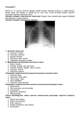 Тохиолдол 7
Өвчтөн А. 31 настай. Эмэгтэй. Дөрвөн жилийн өмнөөс аюулхай орчмоор нь өвдөх болсон.
Өглөө ажилд явж байхад нь хэвлий рүү нь гэнэт нэвт, хүчтэй хатгуулан өвдөж, эмнэлэгт
түргэнээр яаралтай хүргэгдэж ирсэн.
Хэвлийн хөндийн тойм рентген харалтанд: Баруун талын өрцний доор хадуур хэлбэрийн
хий хуралдсан сүүдэр илэрсэн.
Хэвлийн хөндийн тойм рентген зурганд:
1. Оношийг тавина уу?
A. Гэдэсний түгжрэл
B. Ходоодны шархлаа
C. Өрцний ивэрхий
D. Ходоодны шарх цоорох
E. Чацархайн артерийн тромбоз
2. Өрцний дор хий хуралдах шалтгааныг нэрлэ.
1. Давсаг цоорох
2. Хэвлийн хөндийг нээх мэс засал
3. Хэвлийн хөндийн хөндийт эрхтэн цоорох
4. Гэдэсний түгжрэл
5. Ходоодны үрэвсэл
3.Ходоодны шархлаа өвчний үед рентгенд илрэх шинжийг нэрлэ.
1. Симптом Ниша
2. Үрэвслийн хөвөө шинж
3. "Заагч хуруу" шинж
4. Чаши Клойбера
5. Гэдэсний гогцоо өргөсөх
4.Ходоодны шархлаа өвчнийг шинжлэх шинжилгээний аргуудыг нэрлэ.
1. Ирригоскопи
2. Рентгеноскопи, рентгенографи
3. Колоноскопи
4. Дурангийн шинжилгээ
5. Фистулографи
5.Хоол боловсруулах замын рентген шинжилгээнд ашигладаг тодосгогч бодисыг
нэрлэ.
1. Иодын усан уусмал
2. Иодын тосон уусмал
3. Хийн тодосгогч
4. Барийн сульфатын усан уусмал
5. Хүчилтөрөгч
 