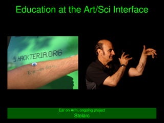    
Education at the Art/Sci Interface
Ear on Arm, ongoing project
Stelarc
 