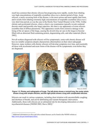 DUST CONTROL HANDBOOK FOR INDUSTRIAL MINERALS MINING AND PROCESSING
OVERVIEW OF DUST EXPOSURE ASSESSMENT AND CONTROL 5
much less common than chronic silicosis but progressing more rapidly, results from inhaling
very high concentrations of respirable crystalline silica over a shorter period of time. Acute
silicosis, a rarely occurring form of the disease, is the most serious and most rapidly fatal form,
and it results from inhaling extremely high concentrations of respirable crystalline silica over a
very short time period, as was the case in the Hawks Nest Tunnel Disaster in the 1930s. Unlike
chronic and accelerated silicosis, where a chest x-ray examination typically reveals scattered
discrete small (and possibly also large) opacities, the chest x-ray appearance of acute silicosis
resembles that of diffuse pneumonia. This appearance results from extensive damage to the
lining of the air spaces of the lungs, causing the alveoli (tiny air sacs in the lungs) to become
filled with an abnormal fluid containing protein, degenerating cells, and other materials [Davis
2002].
Not all workers diagnosed with silicosis will be symptomatic; some with chronic disease will
have no notable symptoms despite characteristic abnormalities on their chest radiograph.
However, many workers with chronic silicosis will develop symptoms over time, and essentially
all those with accelerated and acute forms of the disease will be symptomatic even before they
are diagnosed.
Figure 1.2. Photos and radiographs of lungs. The left photo shows a normal lung, the center photo
shows a lung with simple silicosis, and the right photo shows a lung with complicated silicosis.
Photos by NIOSH
Silicosis can result in various symptoms, including chest irritation with uncontrollable coughing
and shortness of breath, and can be debilitating and warrant therapeutic intervention.
Additionally, those with silicosis are at substantial risk for developing tuberculosis or other
mycobacterial diseases [NIOSH 2002; Davis 2002].2
2
Additional information on silica and silica-related diseases can be found at the NIOSH website at
http://www.cdc.gov/niosh/topics/silica/.
 