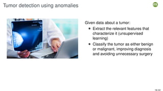 Tumor detection using anomalies
Given data about a tumor:
• Extract the relevant features that
characterize it (unsupervised
learning)
• Classify the tumor as either benign
or malignant, improving diagnosis
and avoiding unnecessary surgery
19 / 61
 