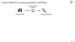 Tumor detection using anomalies: workflow
20 / 61
 